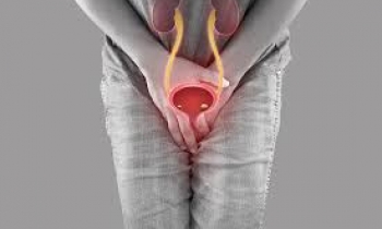 بی اختیاری ادرار در زنان_urinary incontinence