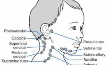 گره لنفاوی گردن_lymphnode _neck