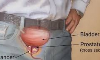 پروستات _اندازه طبیعی برای سن